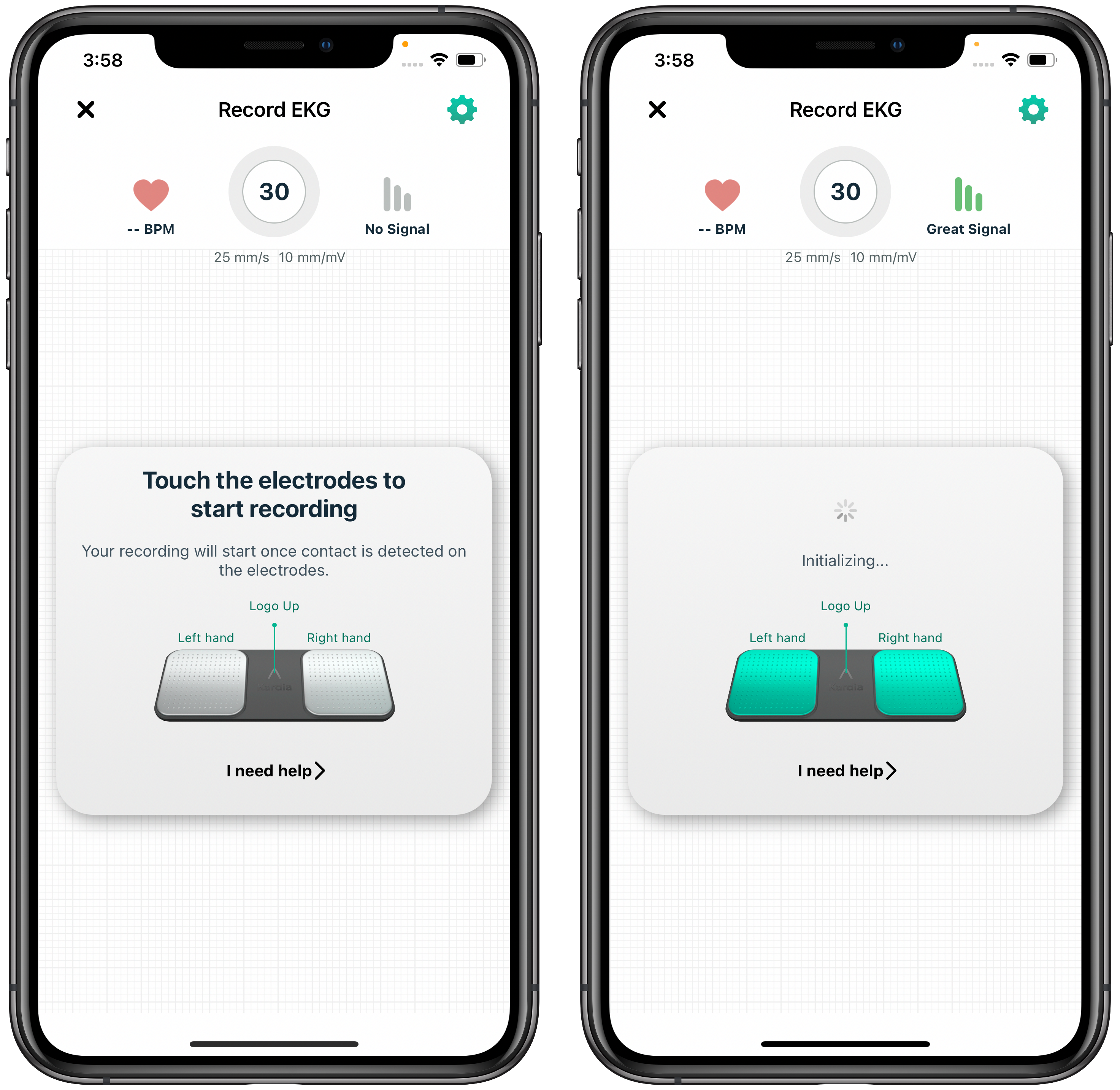 Setting up your KardiaMobile 6L – AliveCor Support